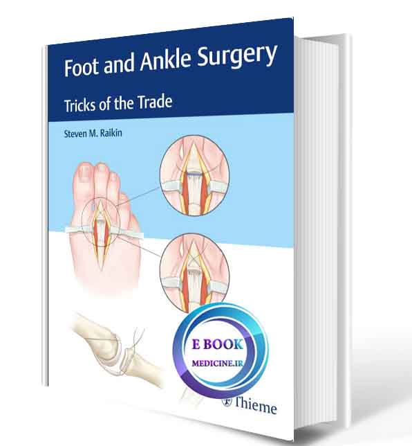 دانلود کتاب Foot and Ankle Surgery: Tricks of the Trade2018 ( ORIGINAL PDF)